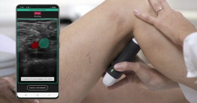 Clarius and ThinkSono Introduce a New AI-Guided Ultrasound System Enabling Rapid Assessments of DVTs